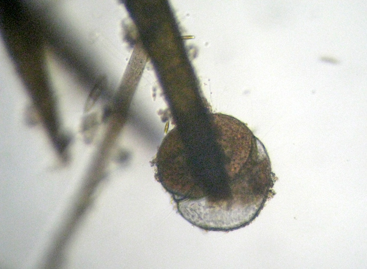 I Foraminifera come non li avevo mai visti!